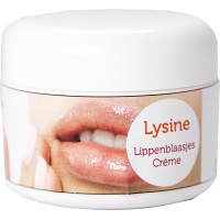 Lippenbalsem met Lysine De Rode Pilaren 